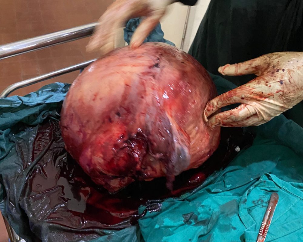 ANP Outreach Onwukwe Foundation 07